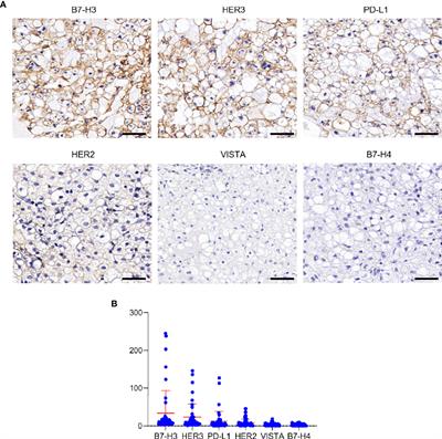 B7-H3 as a Target for CAR-T Cell Therapy in Skull Base Chordoma